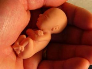 Госдума планирует ввести «неделю тишины» перед абортом